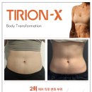 리엑스코리아 이미지