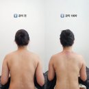 설봉로 | 이천 르영무드 : 승모근, 데콜테 관리로 없어진 목 되찾은 내돈내산 후기