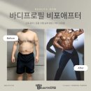 보떼 짐 이미지