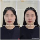 에스테티아김해점 윤곽관리 후기