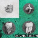 부평안치과의원 | 매복사랑니 발치 후기 신경 마취 통증 치과사랑니
