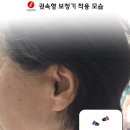 독일시그니아보청기 이미지