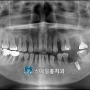 스마일홍치과의원 네이버블로그