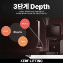 나인원의원 | 한남동피부과 세르프 리프팅, 안아픈 리프팅으로 언급되는 이유 (울써마지 비교)