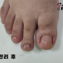 레푸스 사상점 이미지