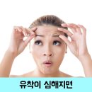 이마 이미지