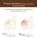 핌한의원 이미지