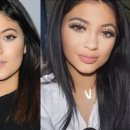 Should Parents Let Teens Get Plastic Surgery Like Kylie Jenner? By Jennifer O'Neill 이미지