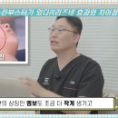 비알팜 | 천안리쥬란 아성을 잇는 스킨부스터가 있다?(리즈네 효과와 차이점)