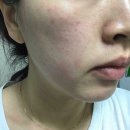 이오스타 이미지