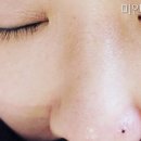 강자안손톱 이미지