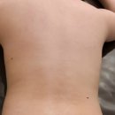 포톤테라 | 일산 주엽 바디관리 잘하는 자디니스파일산점 미모부심 테라노바관리 후기