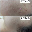 형곡로 | 구미 형곡 피부관리 추천 후기, 왜 재방문이 많은지 알겠던 송현 뷰티