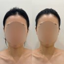 계룡슈퍼 | 대전근교 계룡 윤곽관리 미친후기 고운율 바디앤페이스