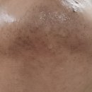 리츠피부과의원 이미지