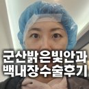 연수늘밝은안과의원 | 군산밝은빛안과 백내장수술후기 아이핸스렌즈 비용,수술과정 및 부작용