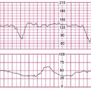 Xy Soft | CMS ObGYn form8 리뷰(score 19)