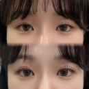 부림제2경로당 | 청주 속눈썹펌 추천, 복대동 멋부림 바짝 속눈썹펌 후기 !