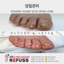 레푸스 남포점 네일포시즌 | [레푸스 남포점] 부산 남포동 무좀발톱이랑 내성발톱 관리 잘하는 네일포시즌레푸스 남포점 추천!!