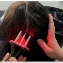 영화블렌하임 | WT메소드 다녀온 후기! 인천탈모 고민해결에 딱인 청라탈모 관리 전문점이에요