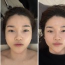 헬로에이피엠 | 홍대 마포 에스테틱 가인미가 신촌 얼굴축소 경락 프리미엄 후기