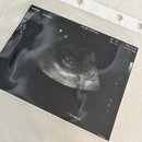 백세약국 | [임신 4-5주] 임신 초기 증상/임신·출산 책/나리여성병원/인천 서구보건소 임신 축하 선물