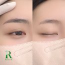 눈썹미리