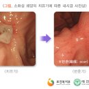 위 이미지