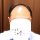 킹스맨가발남성커트 | 남성가발 부분으로 티 안 나게 써본 후기