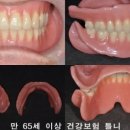 더바른 치과기공소 이미지