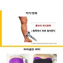 라라테라피