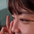 인천 기미,잡티 제거 피부과 추천 before &amp; after 피코토닝 내돈내산