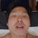 주엽에스테틱 세르모소에스테틱 해외여행으로 뒤집어진 피부회복