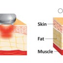 리즈라인의원 이미지