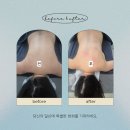 라비에벨뷰티 | 신중동역슬리밍 원장밀착케어 라비에벨뷰티 등케어후기