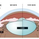 휴안경 이미지