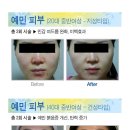 아르케스킨앤바디