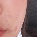 황금마사지 피부관리 이미지