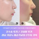 코아약국 | 코수술 후기 코성형 붓기 | 화살코 기증늑 비순각교정 2주차 기록