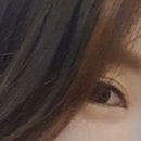 아르보의원 | 눈꺼풀필러(필러잘하는곳)개강추 ㅋㅋ