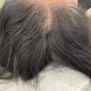 아름헤어라인 - 성남시 수정구 | 아름헤어라인