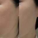 퍼펙트독 | [사진후기] 에버셀 셀 유스 퍼펙트 쿠션 21호 evercell 술톤 지성모공피부 강력추천 기미커버 자외선...