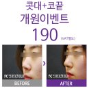 더코성형외과 이미지