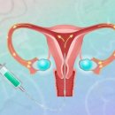 충주부부영상의학과의원 | 안양 하나영상의학과 나팔관 조영술 후기(통증, 시간, 비용)