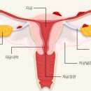 우리가 알던 자궁이랑 나팔관 배치도는 사실 가짜임! 이미지