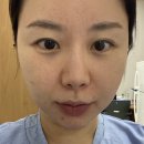 태이에스테틱 네이버블로그