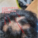 바로스탑한의원 네이버블로그