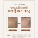 고운미의원 네이버블로그