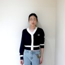 오직얼굴연구소 서초점 | &lt;전후비교&gt; 땅콩형 얼굴, 얼굴길이(중안부), 안면비대칭을 시술과 수술없이 개선한 후기