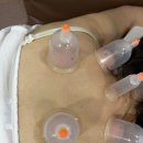 365청담한의원 | 새솔동한의원 통증이 싹 가시게 해준 365청담한의원 다녀왔어요